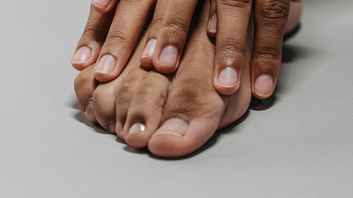 নখের জটিল সমস্যা দেখা দিলে ডার্মাটোলজিস্টের কাছে যাওয়া ভালো