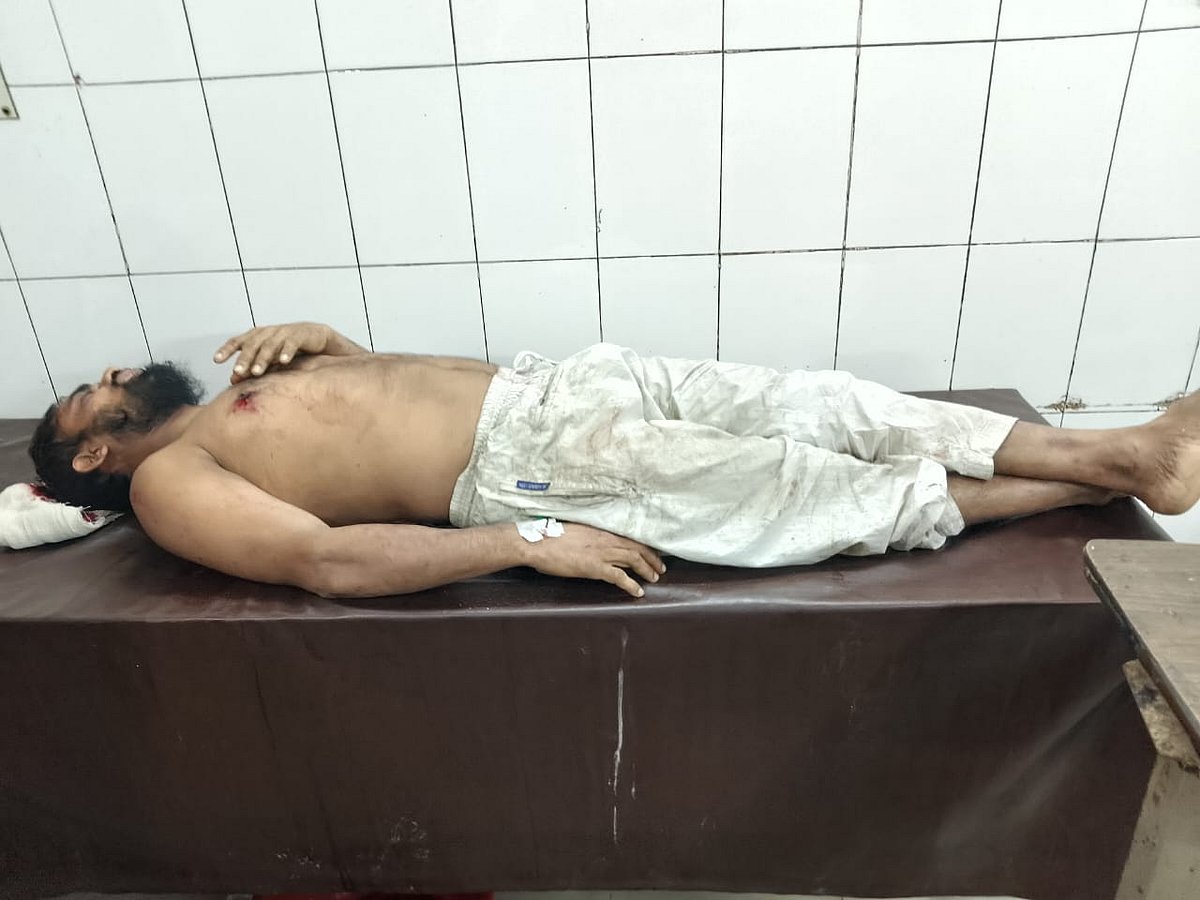 আহত আল মামুনকে ঢাকা মেডিকেল কলেজ হাসপাতালে ভর্তি করা হয়েছে।