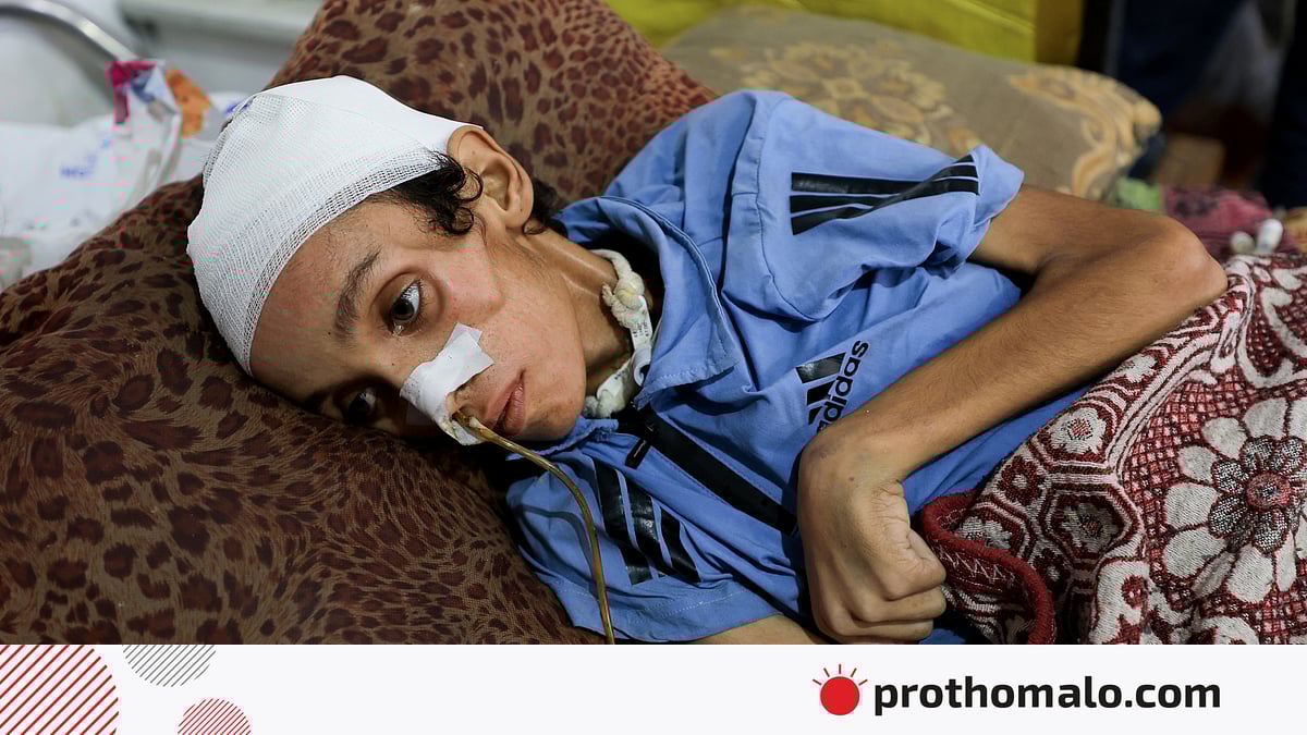 Xeyli Atvell yalangoch Qin infibulyatsiyasi teshilishini yopish uchun halqa