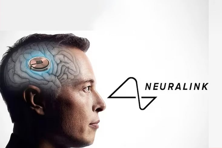 ইলন মাস্কের নিউরালিঙ্ক দুটি সফল অস্ত্রোপচার করেছে