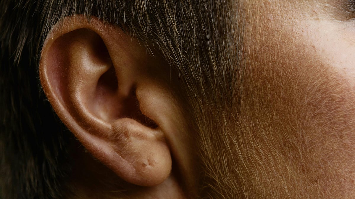 কানের ফারানকুলোসিসের প্রধান কারণ হলো স্ট্যাফিলোকক্কাস অরিয়াস নামক ব্যাকটেরিয়া, যা ত্বকের লোমকূপে প্রবেশ করে সংক্রমণ ঘটায়