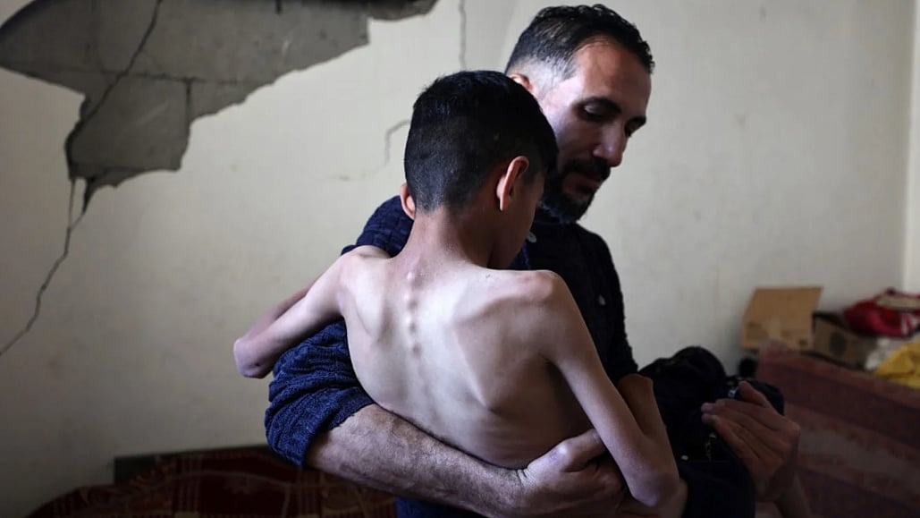 Lesbian barmoq porno