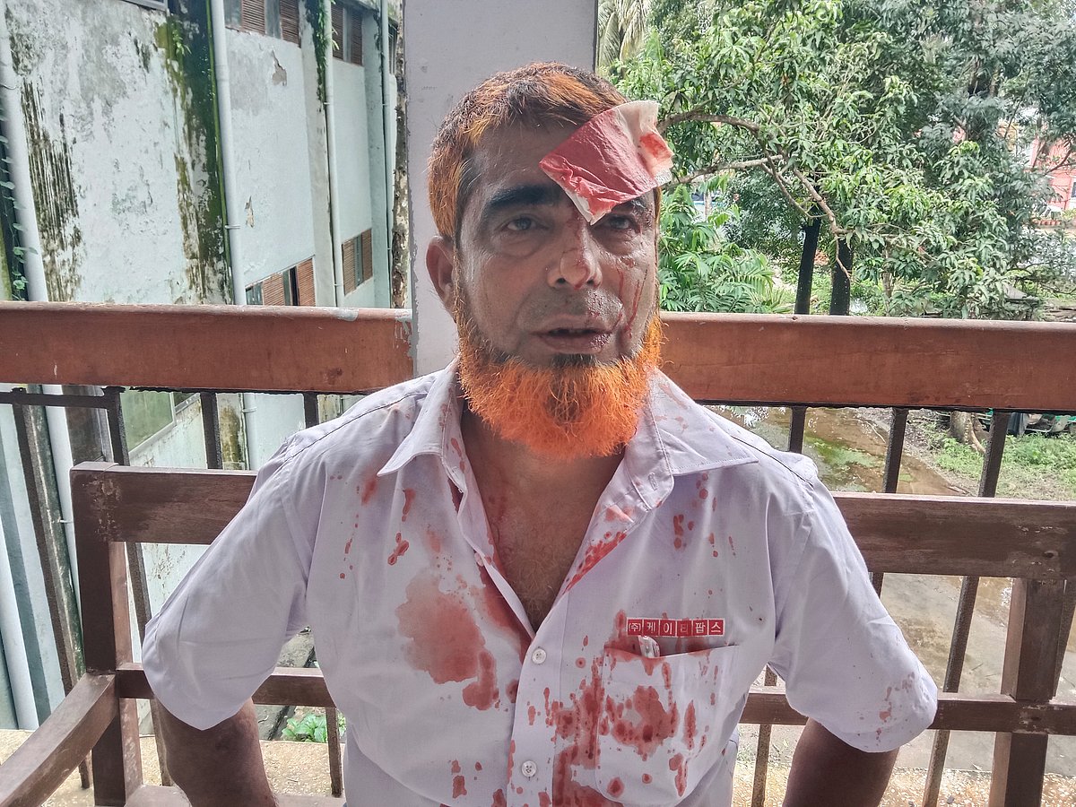 আহত ইউপির সাবেক সদস্য আবদুল মন্নান মৃধা