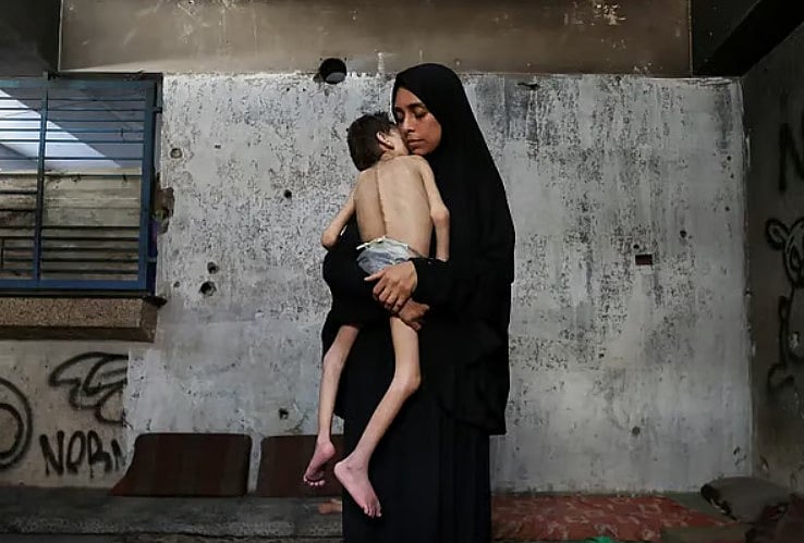 ফিলিস্তিনি মা সামাহ মাতার অপুষ্টিজনিত অসুস্থতায় ভোগা ছেলে ইউসেফকে কোলে ধরে রেখেছেন