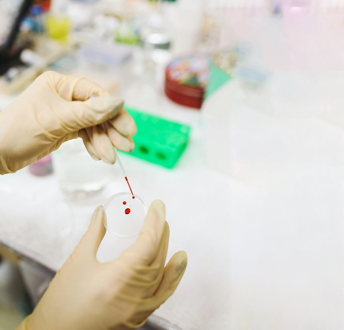 দেশের প্রায় ৩ কোটি ৬০ লাখ শিশুর রক্তে উচ্চমাত্রার সিসা পাওয়া গেছে