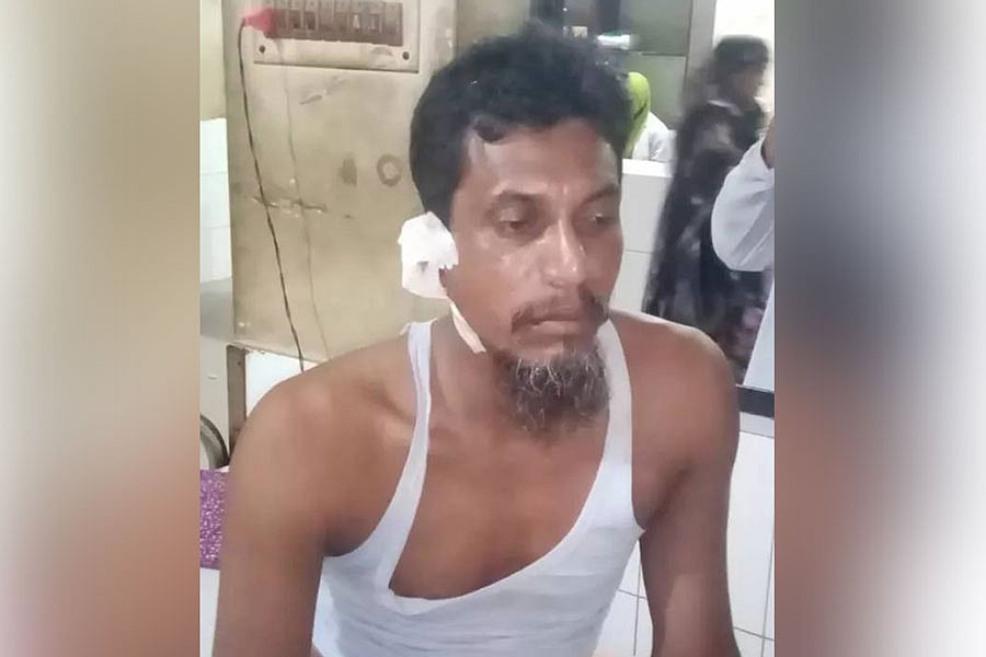 আহত দোকানি আমানুজ্জামান। আজ মঙ্গলবার কুষ্টিয়া জেনারেল হাসপাতালে