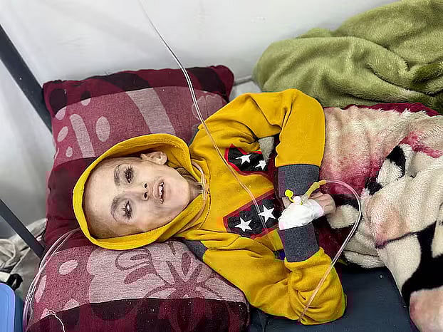 আগে থেকেই অসুস্থ ইয়াজান আল-কাফারনার ছোট্ট শরীর অনাহারের ধাক্কা সামলাতে পারেনি। খাদ্যাভাবে মারাত্মক অপুষ্টি শিকার শিশুটিকে চিকিৎসা দিয়েও তাই বাঁচানো সম্ভব হয়নি