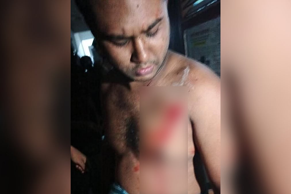রুমমেটকে ছুরিকাঘাতের অভিযোগে ডাকসুর ভিপি প্রার্থী জালাল হল থেকে বহিষ্কৃত |  প্রথম আলো