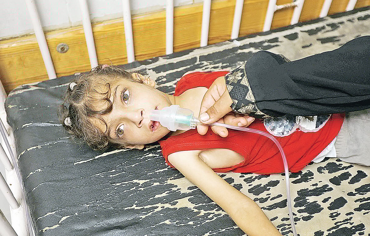 অপুষ্টিতে ভোগা এক ফিলিস্তিনি শিশুর চিকিৎসা চলছে। গতকাল খান ইউনুসের নাসের হাসপাতালে