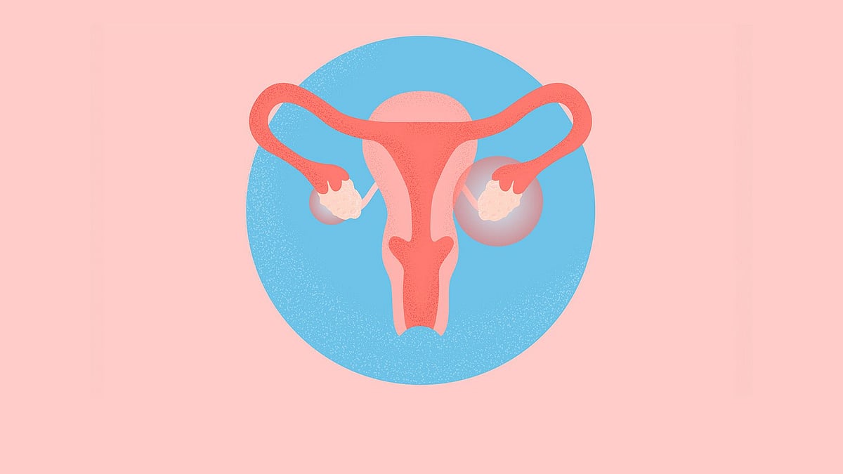 প্রতিবছর সেপ্টেম্বরে বিশ্বজুড়ে পালিত হয় পিসিওএস বা পলিসিস্টিক ওভারি সিনড্রোম সচেতনতা মাস