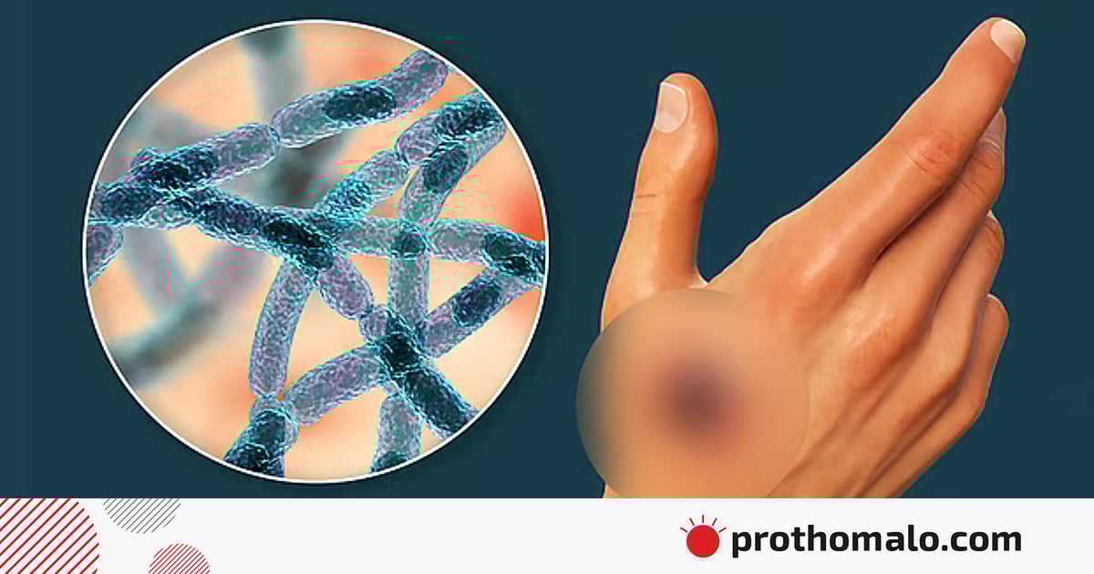 Nudist va naturalist pornosini onlayn tomosha qiling Porno onaning kokraklari