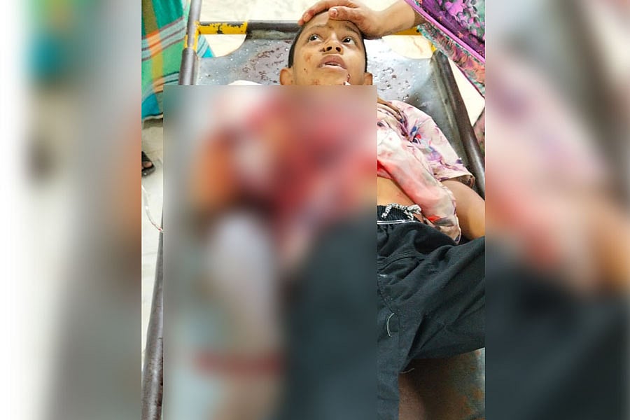 আহত তামিম হোসেন