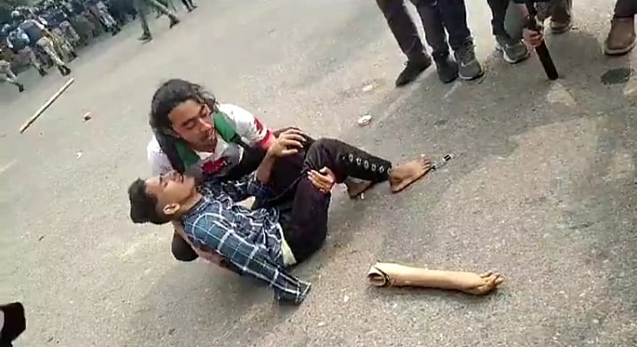 পুলিশের সঙ্গে সংঘর্ষের মধ্যে রাস্তায় পড়ে যান আতিকুল ইসলাম (আতিকুল গাজী)। এ সময় তাঁর কৃত্রিম হাতটিও রাস্তায় পড়ে থাকতে দেখা যায়। আজ বৃহস্পতিবার দুপুরে রাজধানী মানিক মিয়া অ্যাভিনিউয়ে