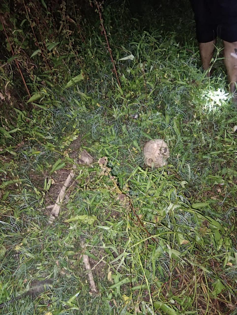 নড়াইলে মাথার খুলি ও শরীরের বিভিন্ন অংশের হাড়গোড় উদ্ধার করা হয়েছে।গতকাল শনিবার