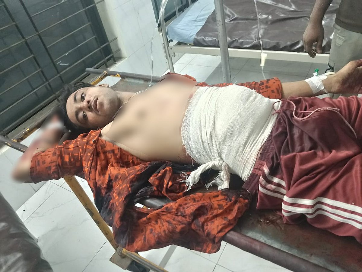 ঢাকা মেডিকেল কলেজ হাসপাতালে চিকিৎসাধীন নিয়াজ আহমেদ। ঢাকা, ২৪ অক্টোবর, ২০২৫।