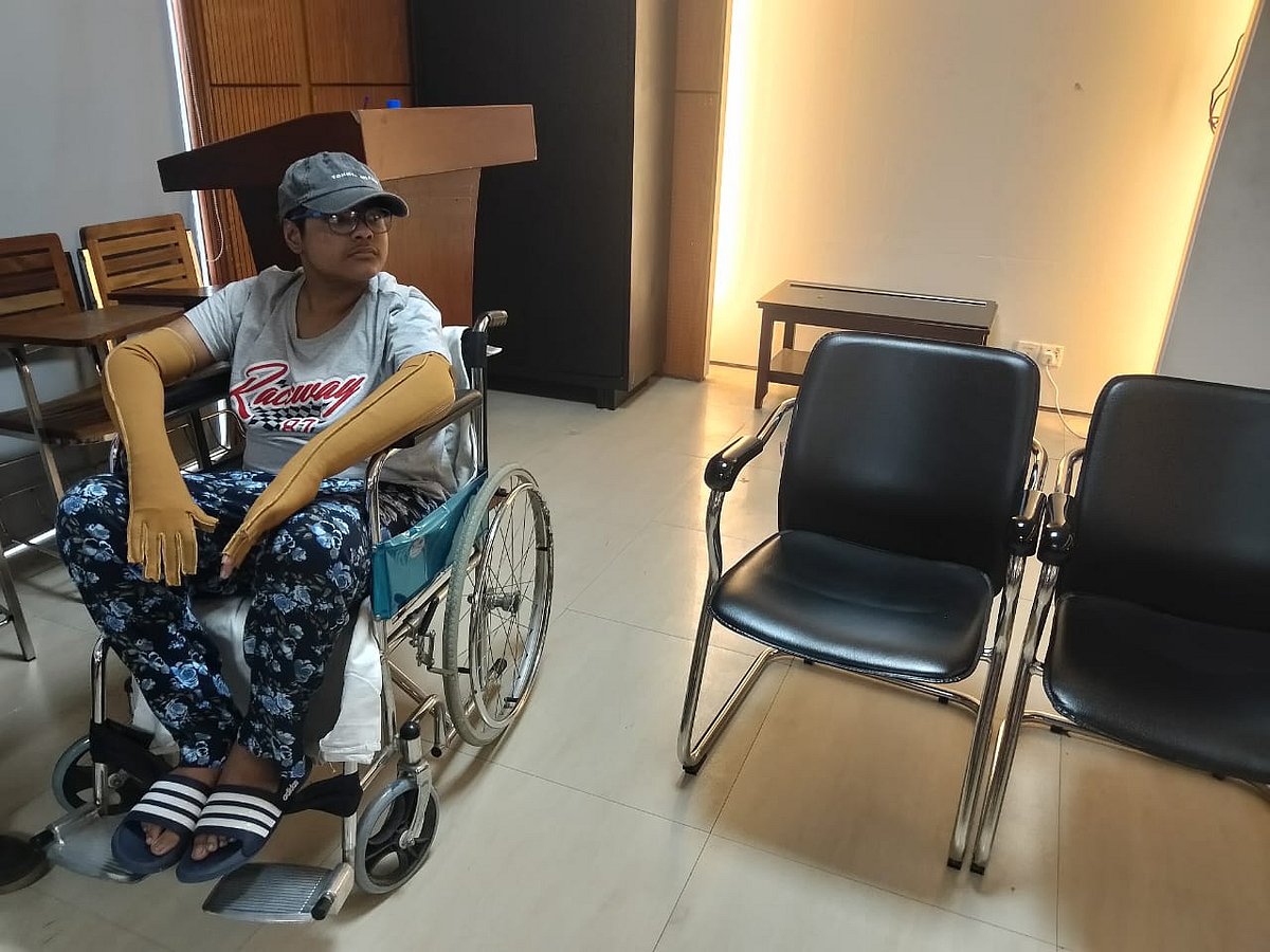 নাভিদ নাওয়াজ দীপ্ত। ৯৭ দিন চিকিৎসাধীন থাকার পর জাতীয় বার্ন অ্যান্ড প্লাস্টিক সার্জারি ইনস্টিটিউট থেকে আজ ছুটি পেয়েছে