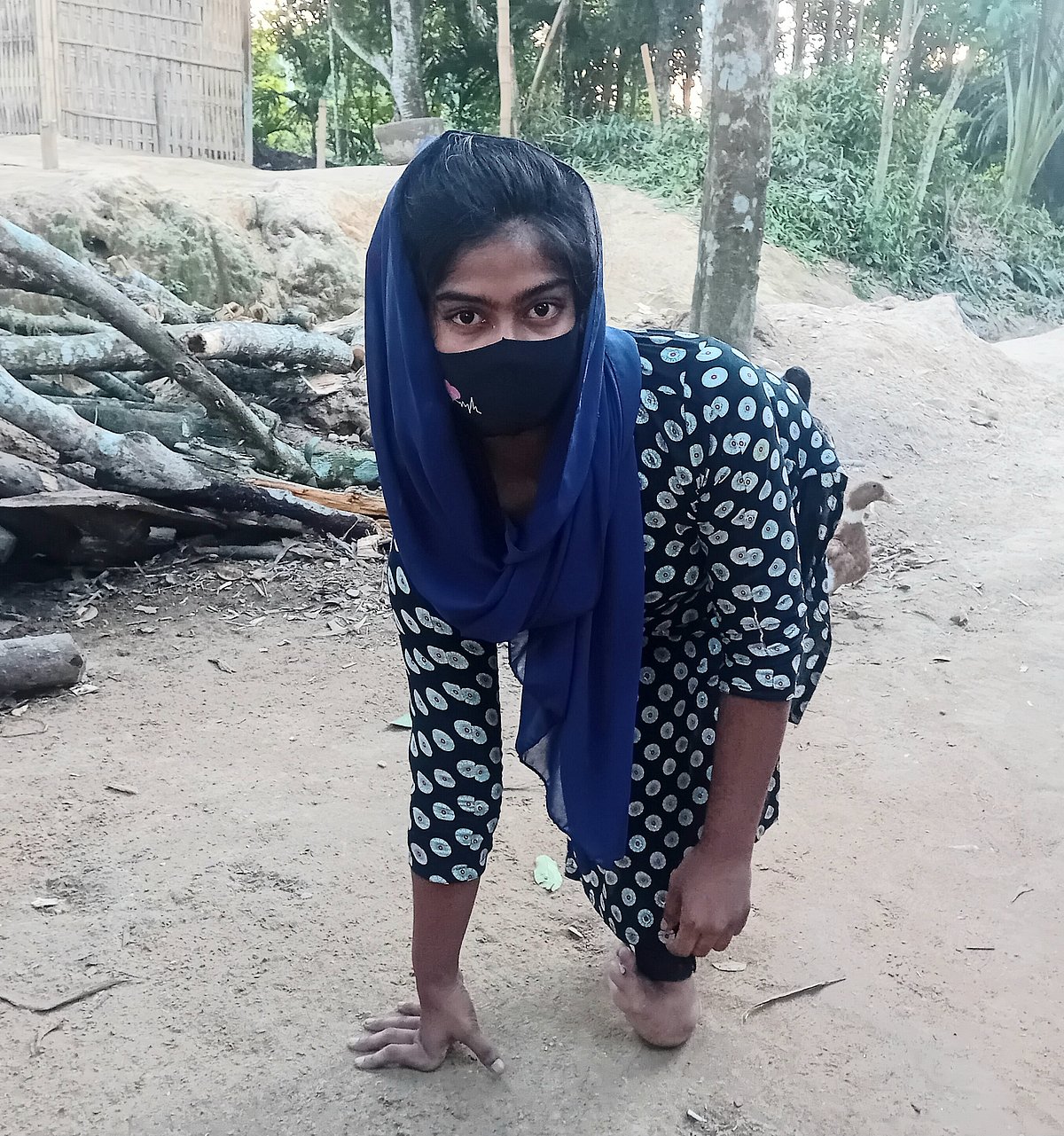 হামাগুড়ি দিয়ে চলাফেরা করেন মনা। সম্প্রতি তোলা