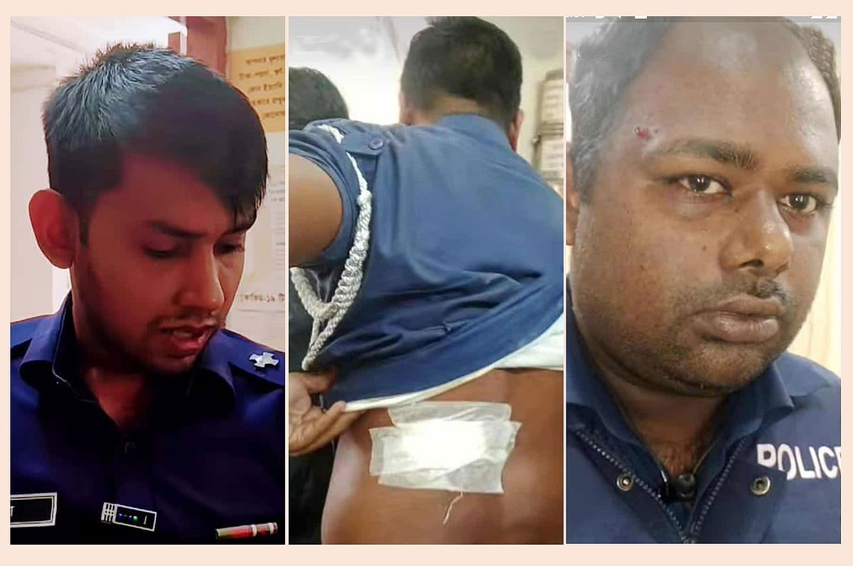 হামলায় আহত এক উপপরিদর্শক ও দুই কনস্টেবল। আজ দুপুরে ফেনীর পরশুরাম উপজেলা স্বাস্থ্য কমপ্লেক্সে