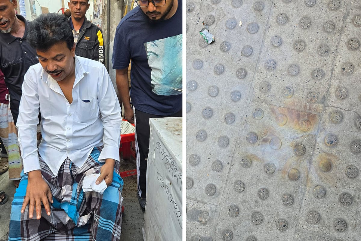 ককটেল বিস্ফোরণে আহত পথচারীর নাম আবদুল বাসির। নিউ ইস্কাটন রোড, ঢাকা, ১৬ নভেম্বর ২০২৫