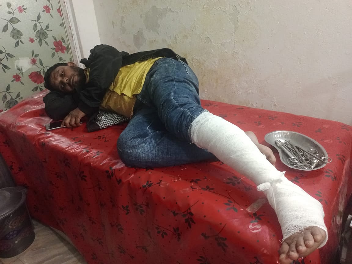 ময়মনসিংহের ত্রিশালে সংবাদ সংগ্রহের সময় পিটিয়ে পা ভেঙে দেওয়া হয় সাংবাদিক মতিউর রহমানের। পরে তাঁকে প্রথমে উপজেলা স্বাস্থ্য কমপ্লেক্সে নেওয়া হয়। ছবিটি গতকালের