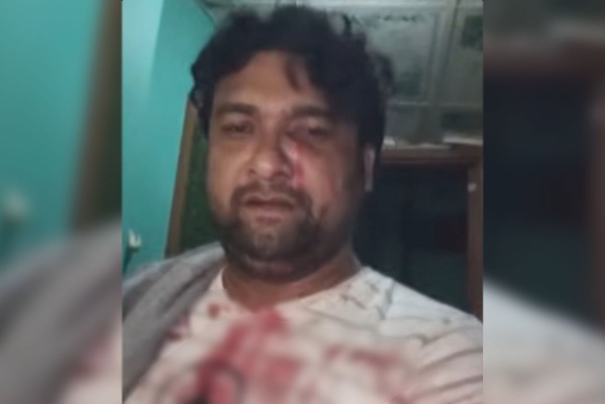 রাজশাহীর বাগমারা উপজেলায় হামলায় আহত যুবদল নেতা এসএম আরিফুল ইসলাম