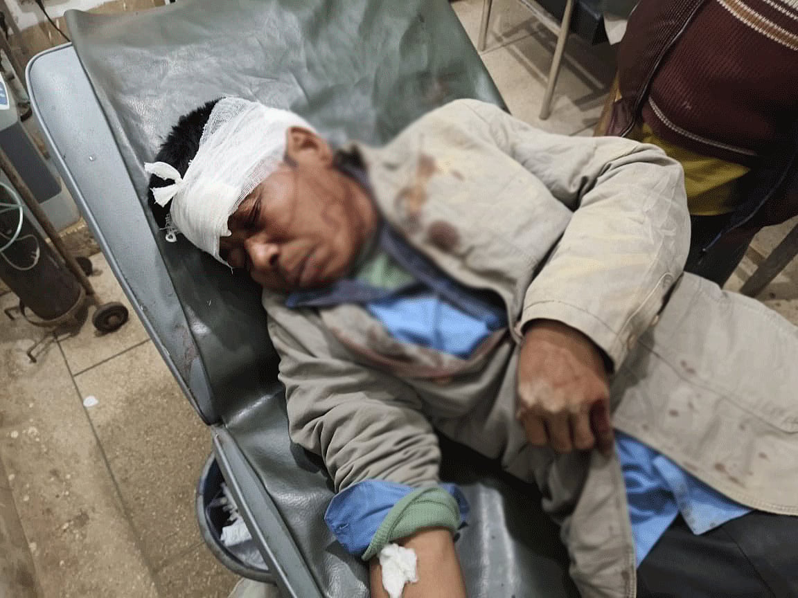 হামলায় আহত প্রেক্য ম্রো নামের এক গ্রামবাসী