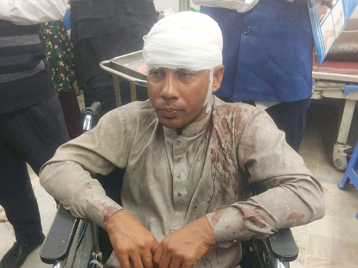 চৌদ্দগ্রামে জামায়াত ও বিএনপির নেতা-কর্মীদের মধ্যে সংঘর্ষে আহত এক ব্যক্তি