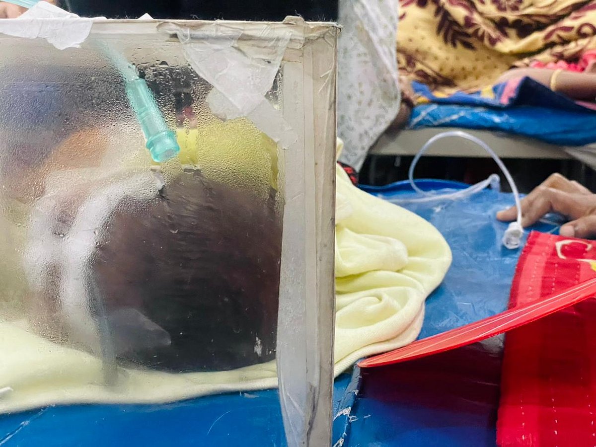 শিশু ওয়ার্ডে কাচের ঘেরাটোপে শুয়ে আছে ছয় মাস বয়সী হাসান। ১৯ দিন আগেই একই লড়াইয়ে মৃত্যু হয়েছে তার যমজ ভাই হোসেনের। ৩১ জানুয়ারি ঢাকা মেডিকেল কলেজ হাসপাতালে