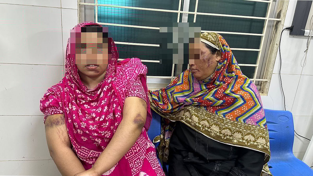 কারাগার থেকে মুক্তি পেয়ে হাসপাতালে চিকিৎসা নেন মা–মেয়ে। এ সময় আঘাতের চিহ্ন সাংবাদিকদের দেখান তাঁরা। গতকাল রাতে চকরিয়া উপজেলা স্বাস্থ্য কমপ্লেক্সে