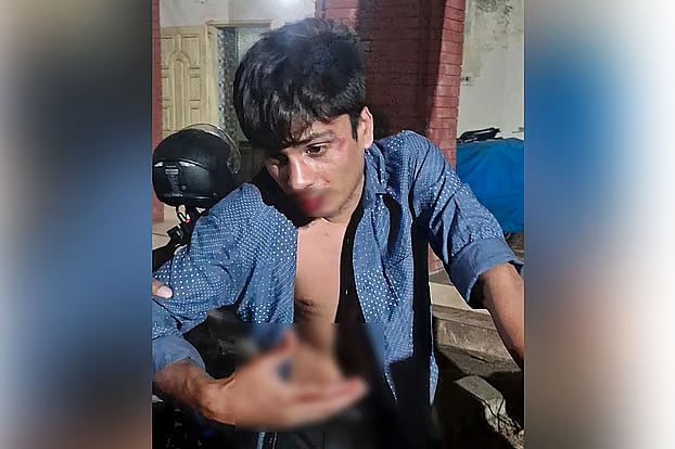 আহত ঢাকা বিশ্ববিদ্যালয়ের শিক্ষার্থী রাহিদ খান পাভেল