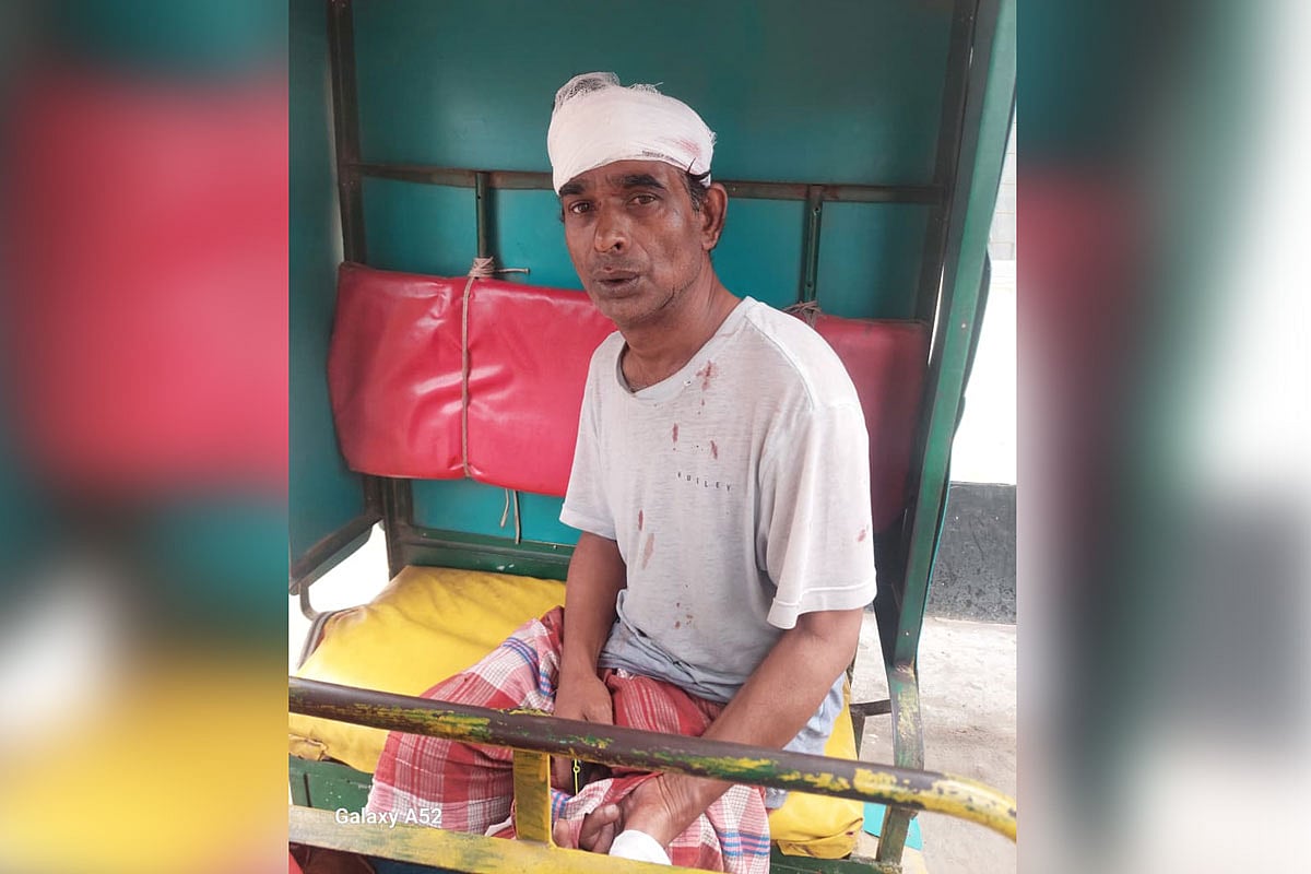 আহত শ্যামল দাস। আজ রোববার সকালে খানপুরের নারায়ণগঞ্জ সরকারি হাসপাতালের সামনে