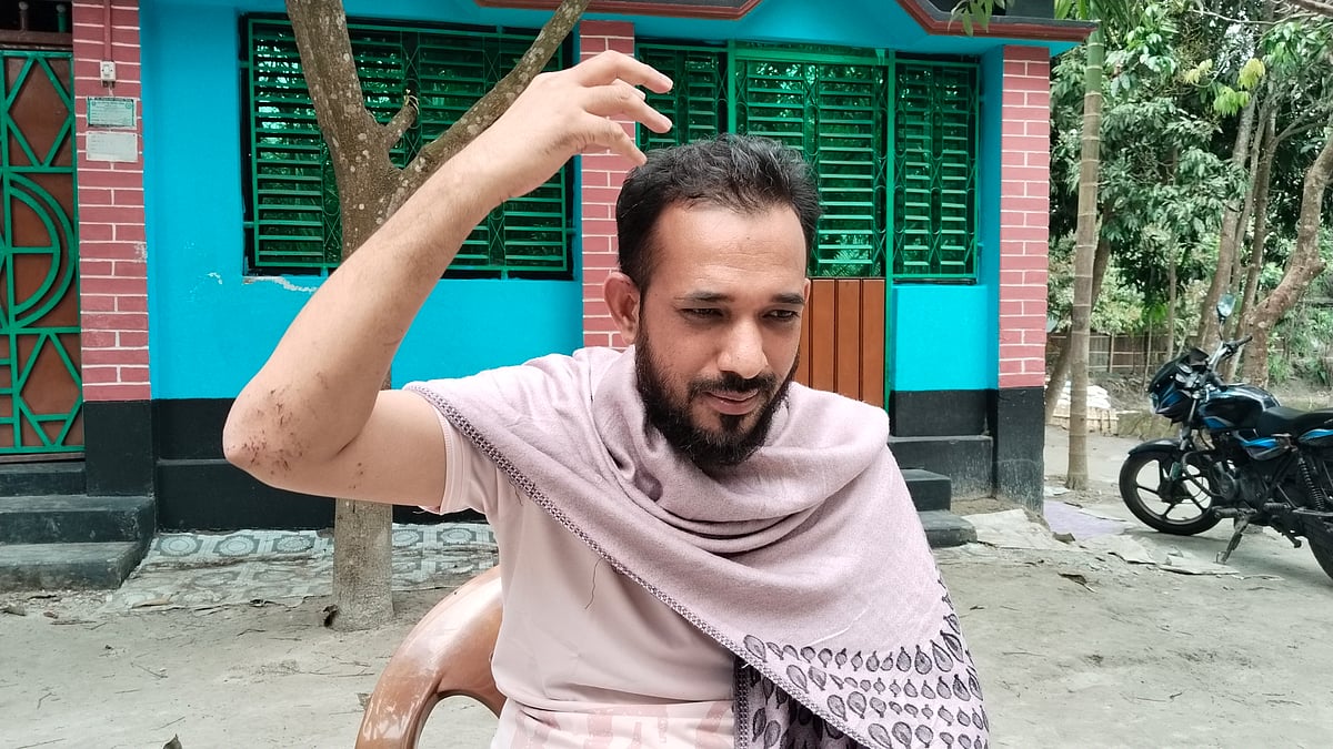 দুর্ঘটনার বর্ণনা দিচ্ছেন দুর্ঘটনাকবলিত গাড়িতে থাকা তরিকুল ইসলাম। আজ বৃহস্পতিবার দুপুরে রংপুরের কাউনিয়ার তালুক শাহাবাজ গ্রামে