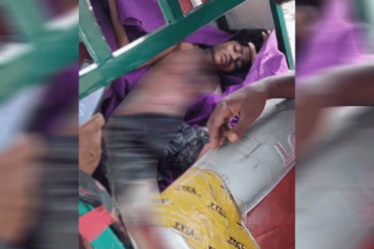 উখিয়া সীমান্তের নাফ নদীর শূন্যরেখায় স্থলমাইন বিস্ফোরণে আহত রোহিঙ্গা যুবক মো. শহিদুল। আজ দুপুরে