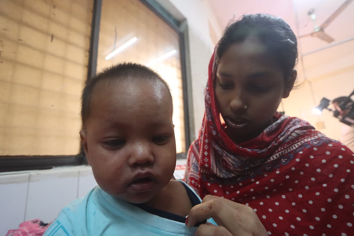 রংপুর মেডিকেল কলেজ হাসপাতালের আইসোলেশন ওয়ার্ডে চিকিৎসাধীন হাম আক্রান্ত ৯ মাস বয়সী সায়েম। সোমবার দুপুরে