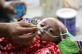 ময়মনসিংহে হামের লক্ষণ নিয়ে ৯ মাস বয়সী শিশুর মৃত্যু, ভর্তি …