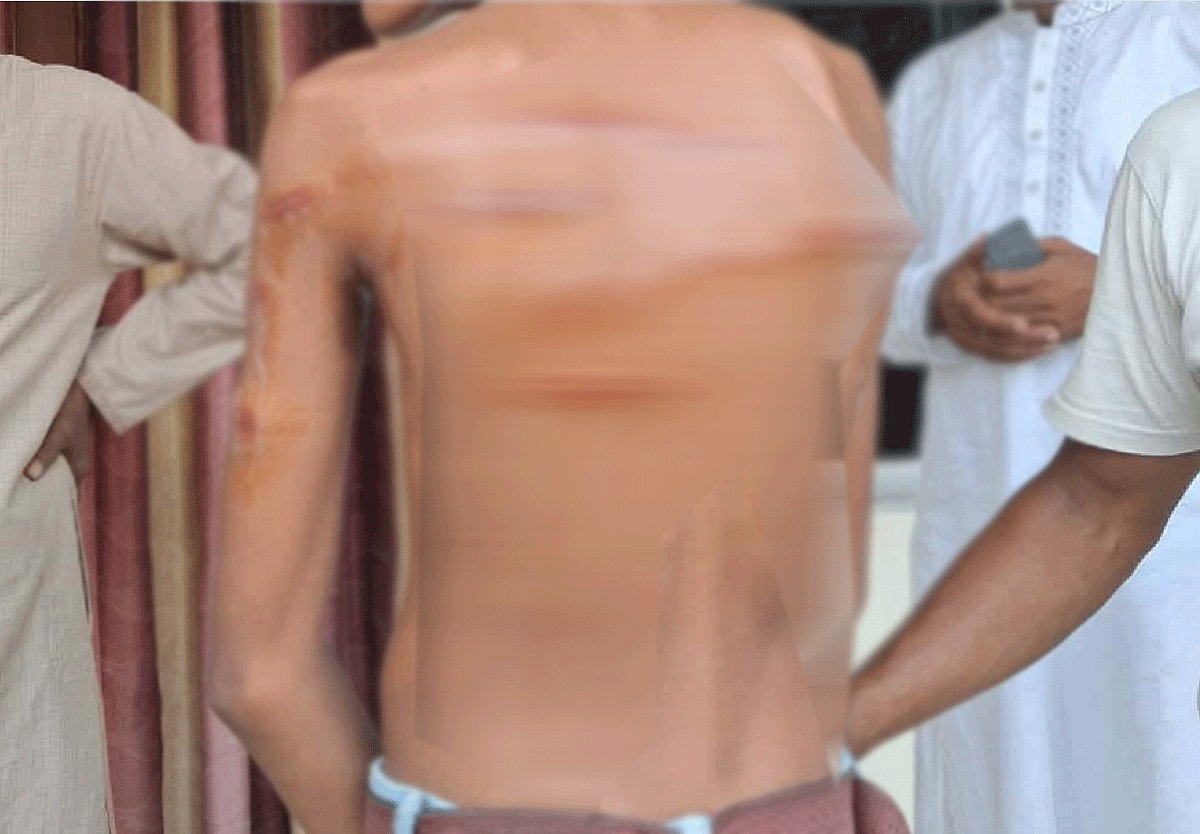শ্রেণিকক্ষে পড়া না পারায় এক শিক্ষার্থীকে এভাবেই বেত্রাঘাত করেন এক শিক্ষক। রাজবাড়ীর পাংশায়