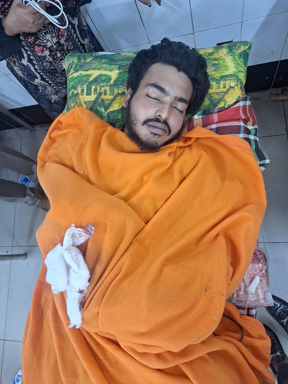 গুরুতর আহত ছাত্রলীগ নেতা  জাকারিয়া হাসান জিলহানকে ঢাকার পঙ্গু হাসপাতালে নেওয়া হয়েছে