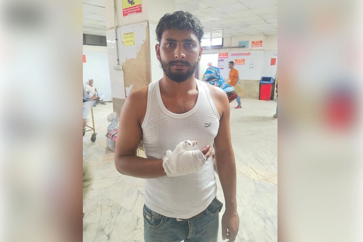 কোরবানির পশু ও মাংস কাটাকাটি করতে গিয়ে আহত হয়েছেন শতাধিক ব্যক্তি। তাঁদের একজনের হাতে ব্যান্ডে করা হয়েছে। আজ বৃহস্পতিবার বিকেলে ঢাকা মেডিকেল কলেজ হাসপাতালে