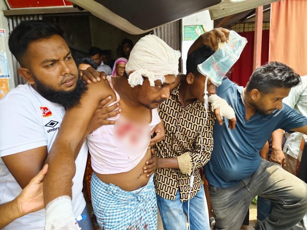 কুমারখালী পৌর ভবনে যুবলীগ নেতার ভাইকে এলোপাতাড়ি কুপিয়ে জখম