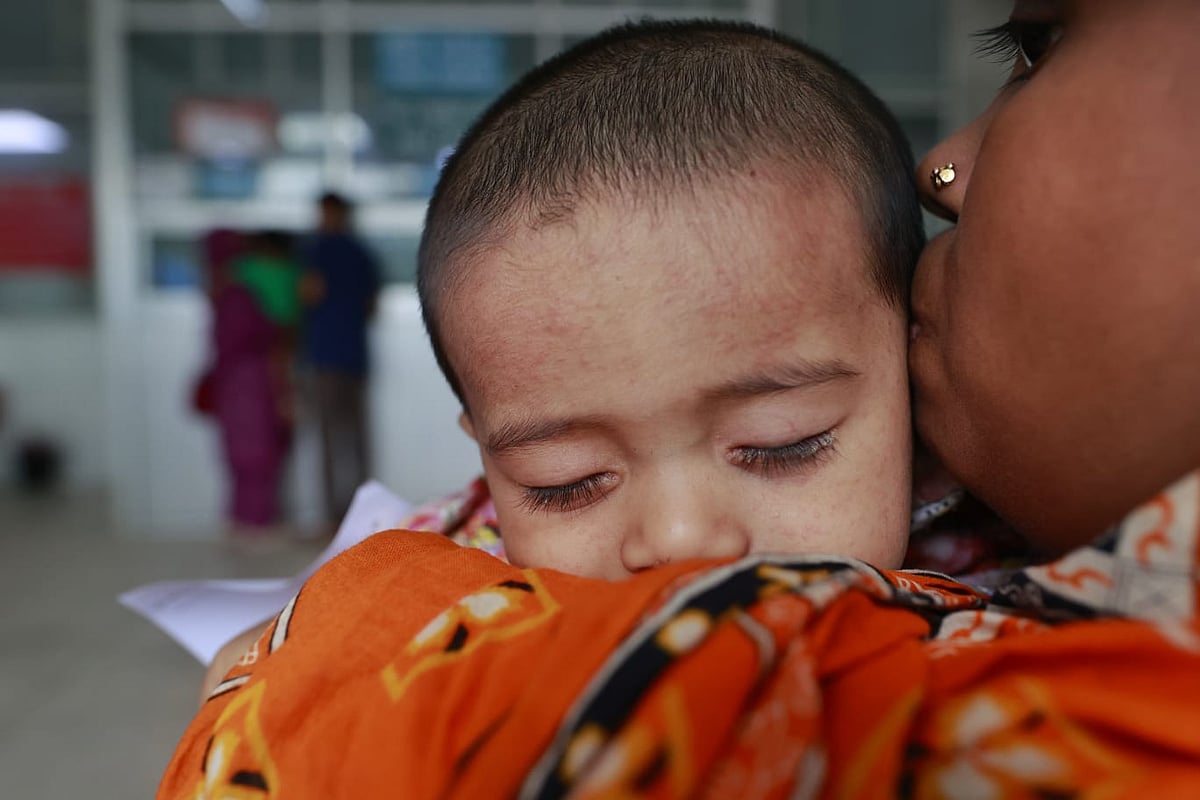 হামের উপসর্গে তিন বিভাগে তিন শিশুর মৃত্যু, মোট মৃত্যু ৬৮৩