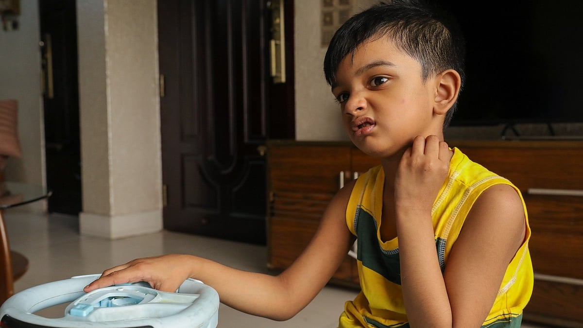 শৈশবে কেন ঘামাচি বেশি হয়
