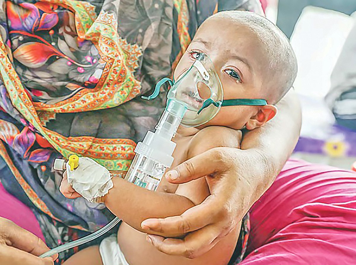 রাজধানীর মহাখালী ডিএনসিসি ডেডিকেটেড কোভিড-১৯ হাসপাতালে হামে আক্রান্ত এক শিশুকে নেবুলাইজ করা হচ্ছে