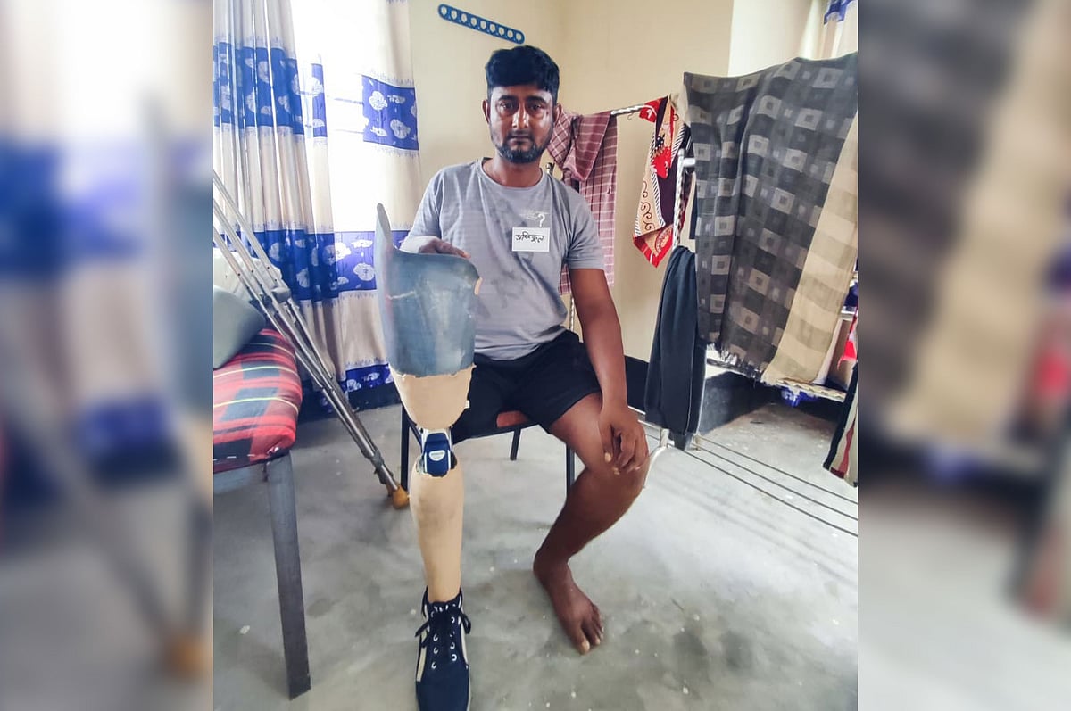 পা হারিয়েও জুলাই যোদ্ধা সফিকুল ভাতা পাচ্ছেন ‘খ’ শ্রেণির