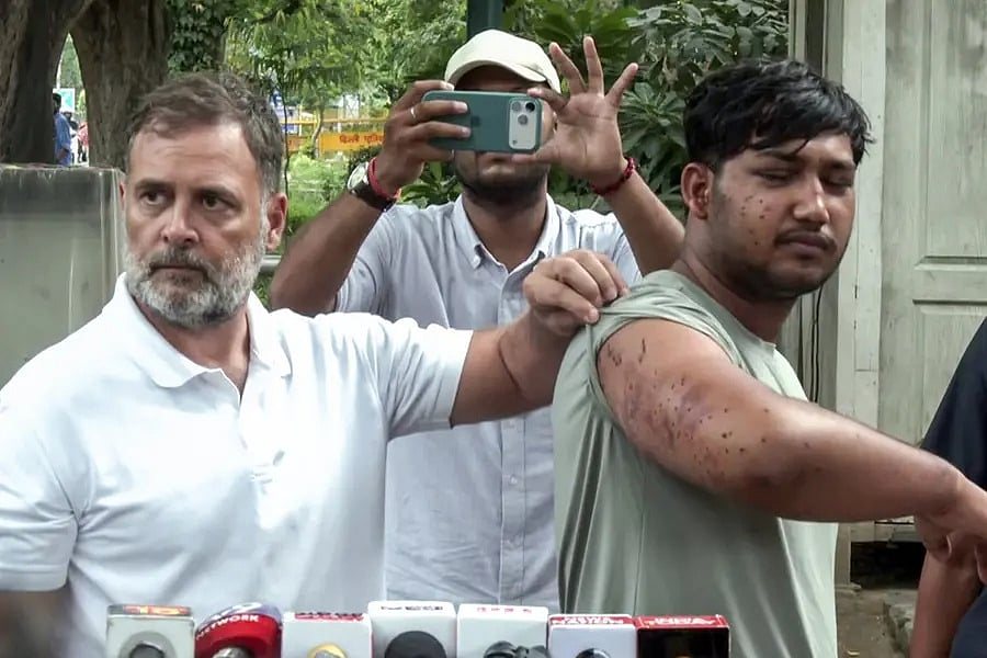 নিরাপত্তা বাহিনীর ছোড়া ছররা গুলিতে আহত এক তরুণকে দেখাচ্ছেন কংগ্রেস নেতা রাহুল গান্ধী। ২৪ জুলাই ২০২৬, নয়াদিল্লি