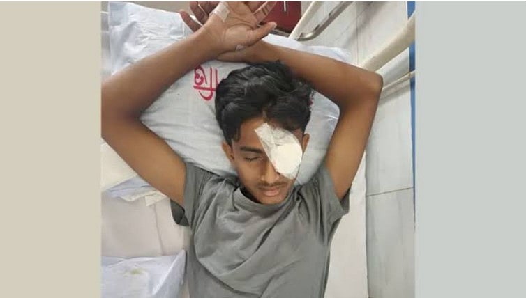 হবিগঞ্জে এনসিপির কর্মসূচিতে ছাত্রদলের হামলায় গুরুতর আহত আলিফ