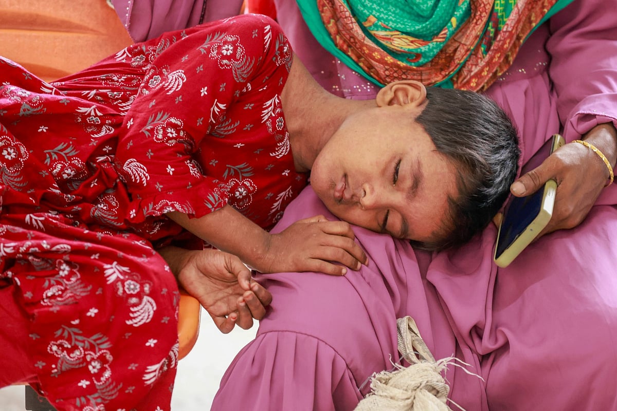 হামের উপসর্গ দেখা দেওয়ায় চিকিৎসার জন্য শিশুদের হাসপাতালে নিয়ে এসেছেন অভিভাবকেরা। রাজধানীর মহাখালীর ডিএনসিসি ডেডিকেটেড কোভিড-১৯ হাসপাতালে