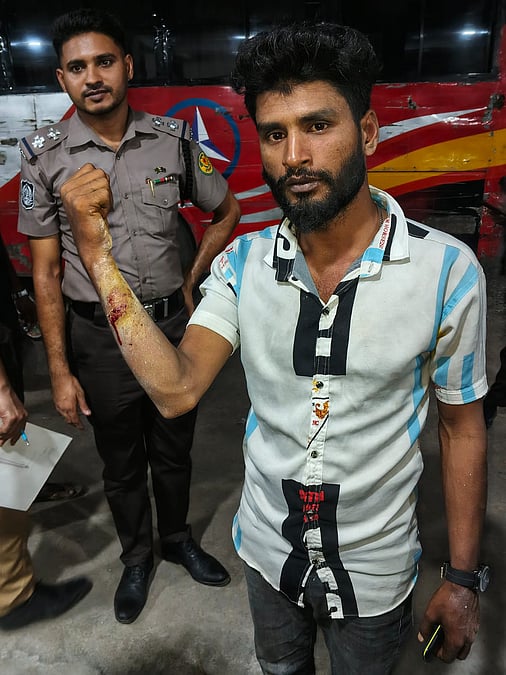 যাত্রাবাড়ীতে ককটেল বিস্ফোরণ, অটোচালক আহত