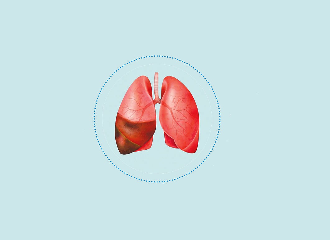 The risk of diabetes is severe.