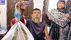সাপ ধরে খেলা দেখাতে গিয়ে কামড়ে আহত, পরে ব্যাগে ভরে হাসপাতালে বৃদ্ধ