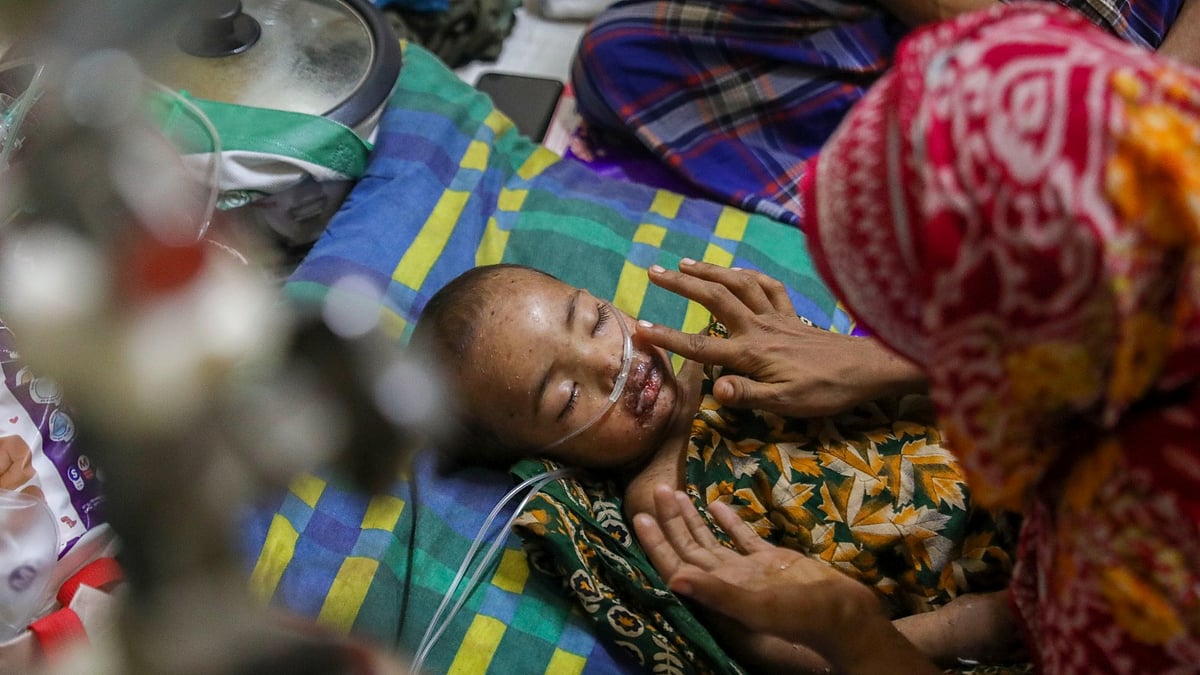 Measles outbreak: 2 sons in 2 hospitals; father left distraught